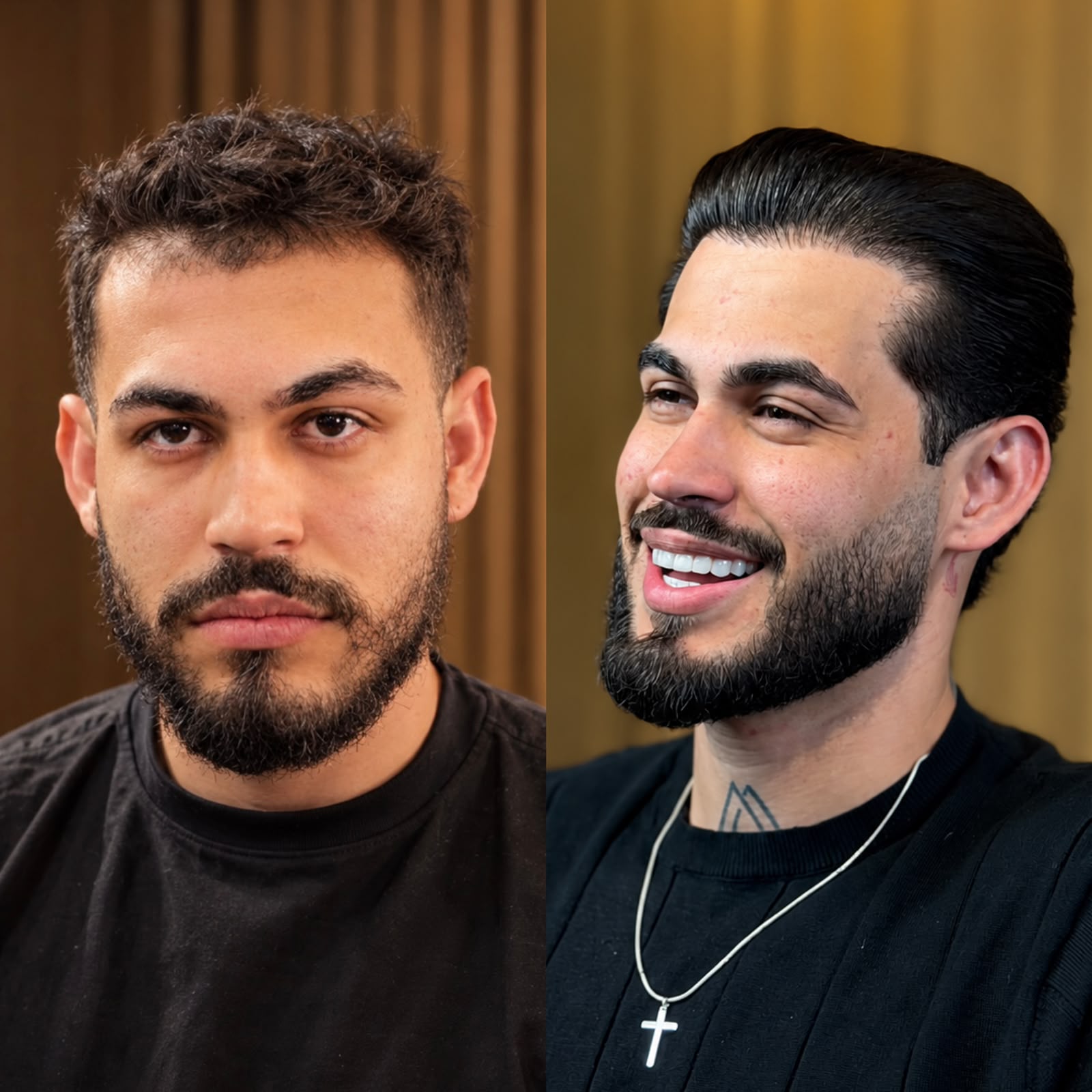 Antes e depois de visagismo no Mr. Jofley — resultado 1